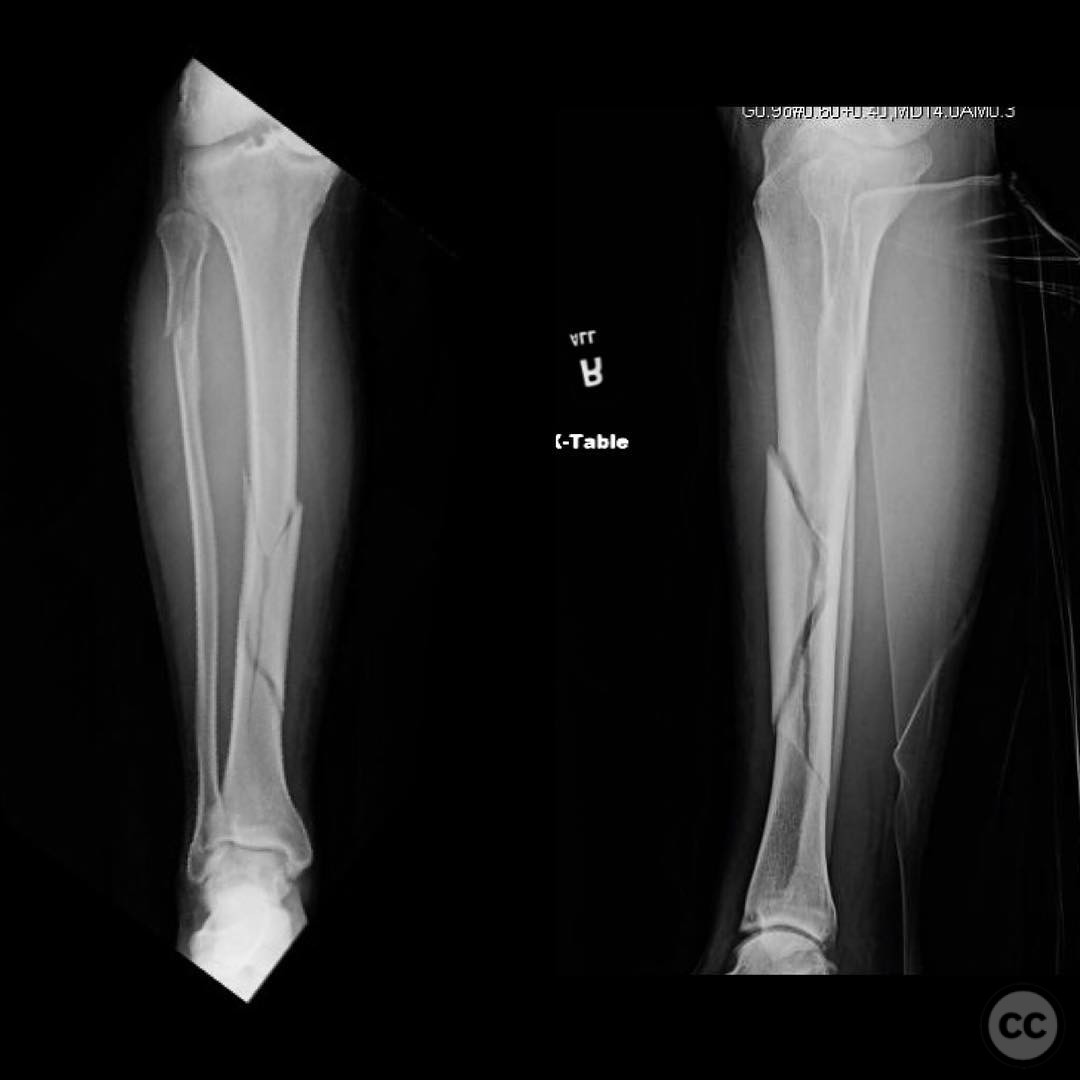 case image