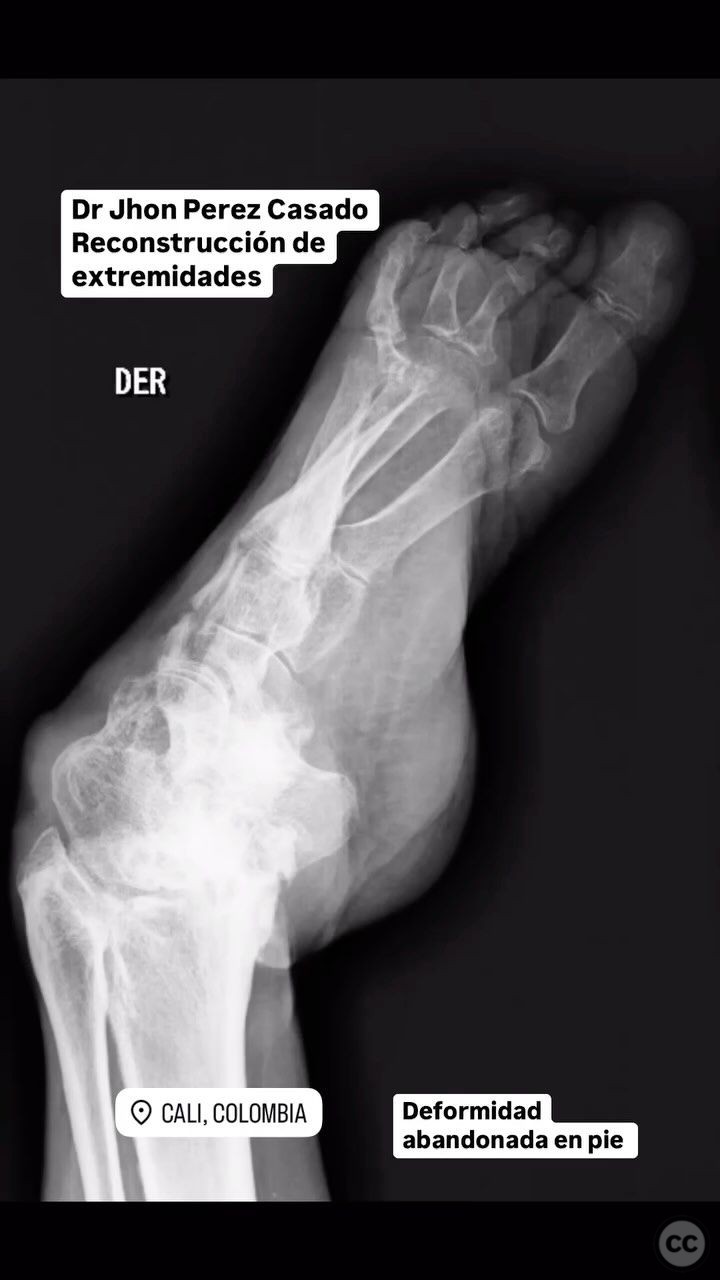 case image