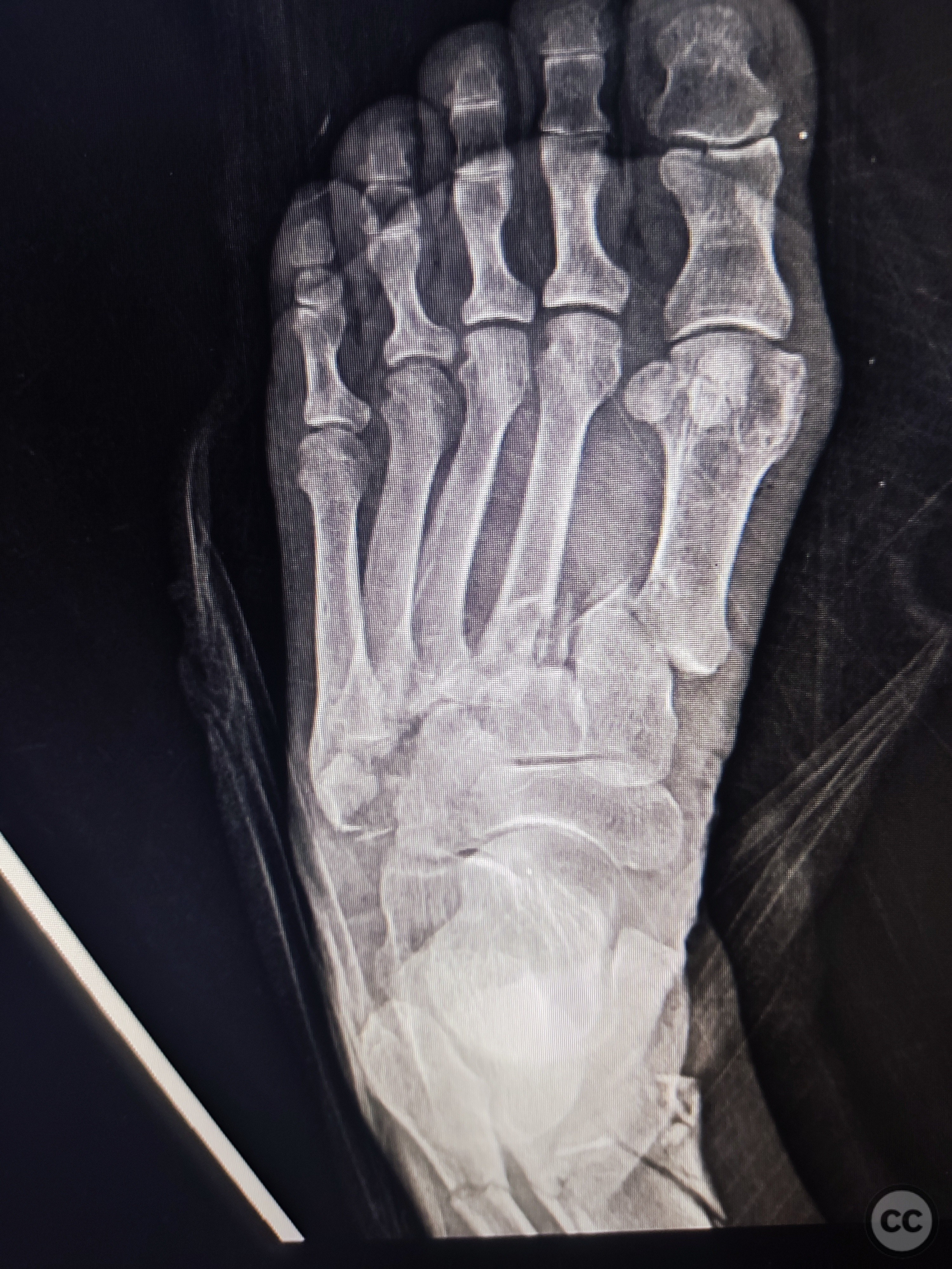 case image