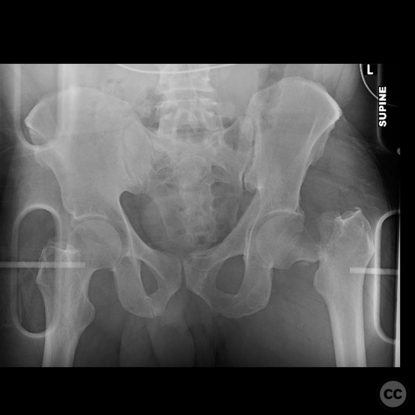 case image