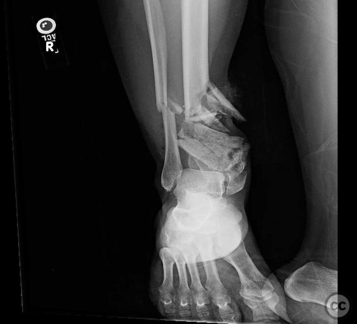 case image