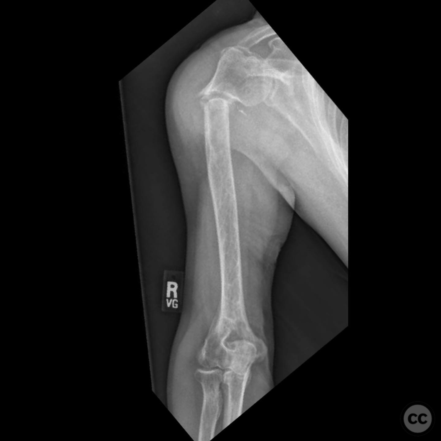 case image