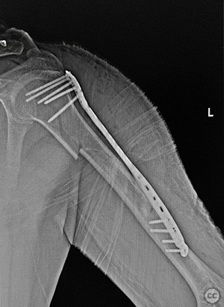 case image