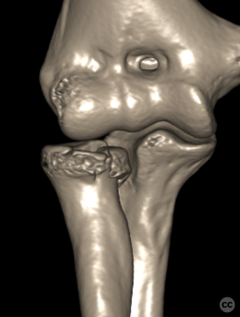 case image