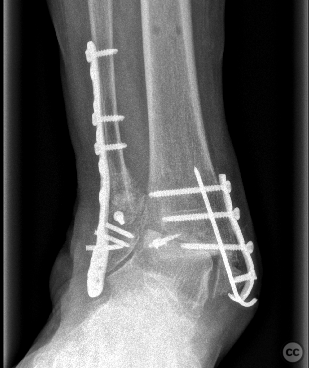 case image