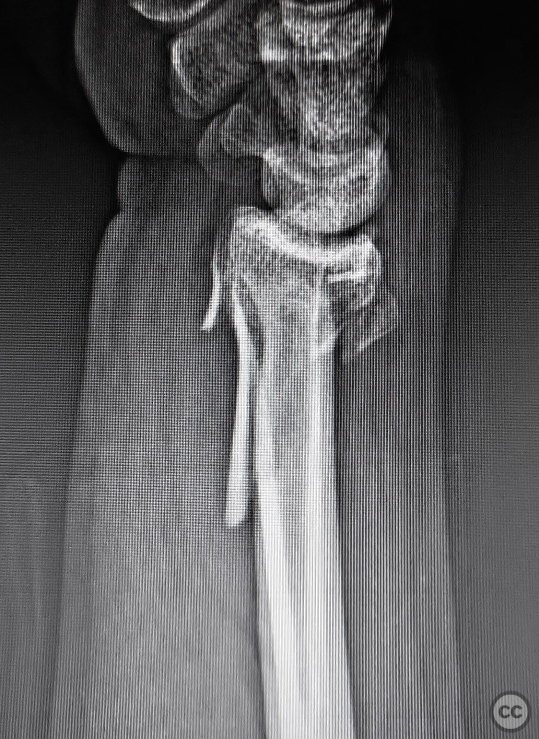 case image