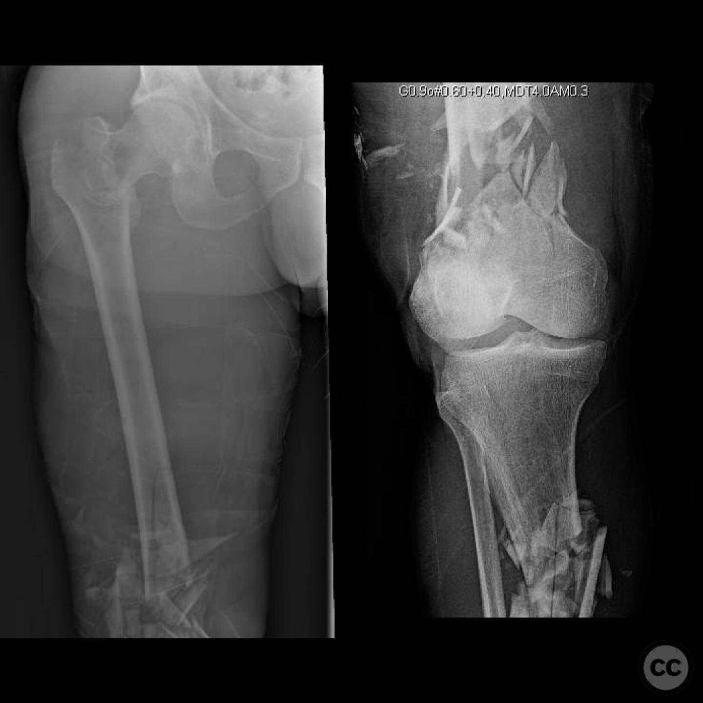 case image