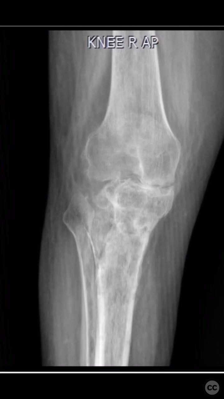 case image