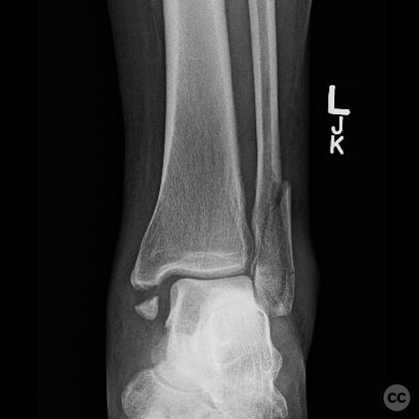 case image