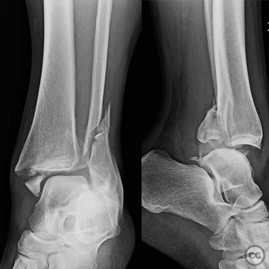 case image