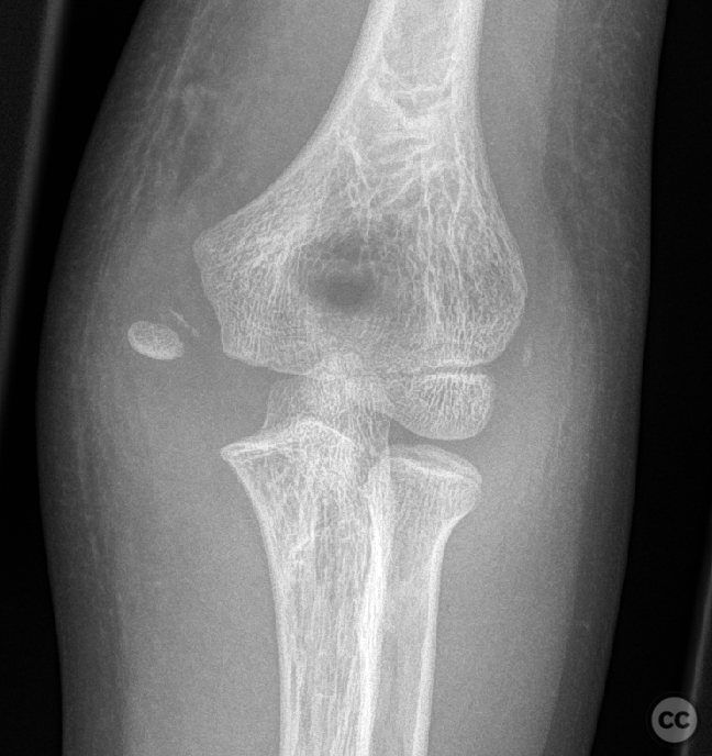 case image