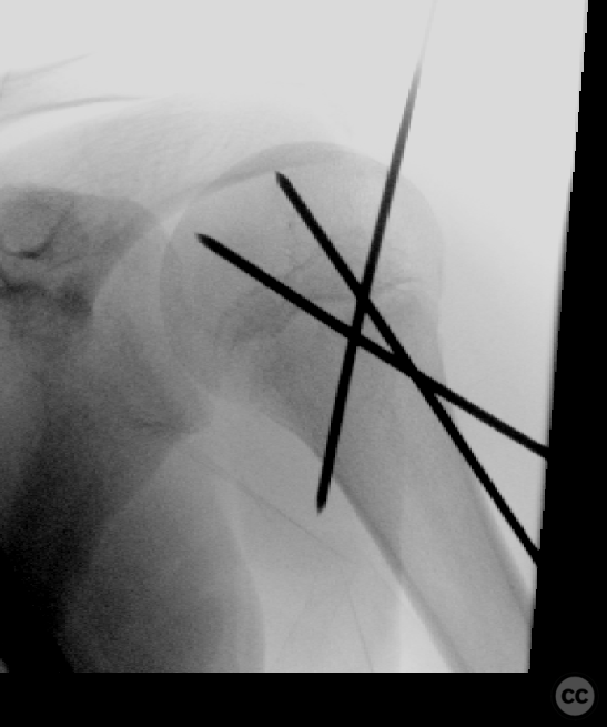 case image