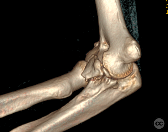 case image