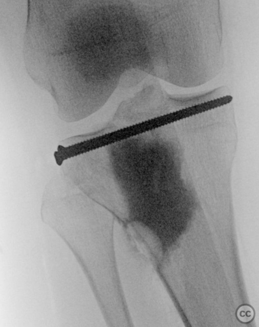 case image
