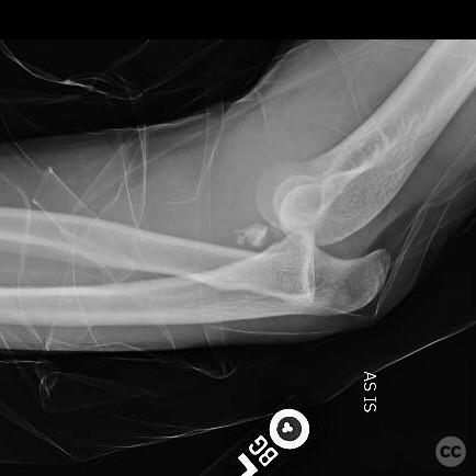 case image