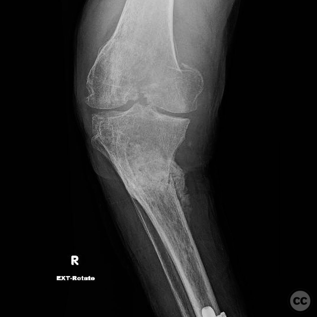 case image
