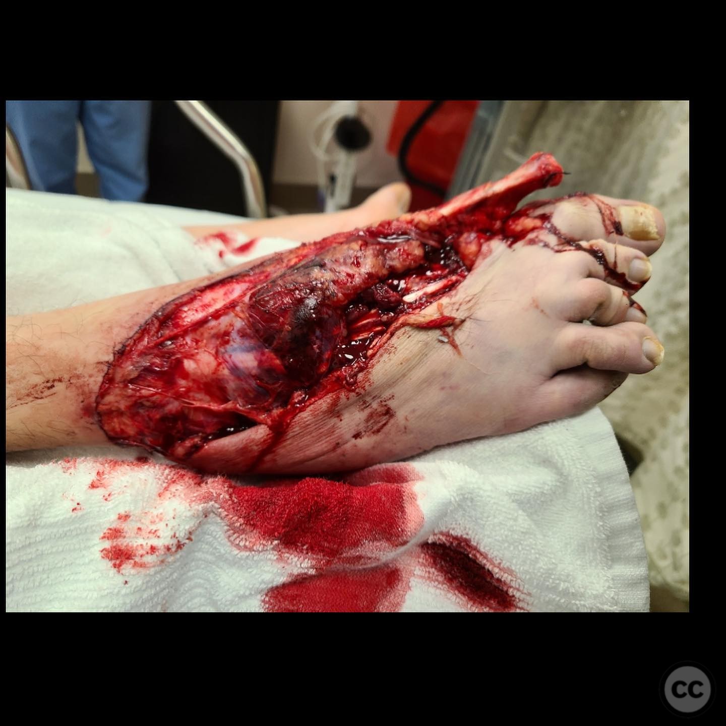 case image