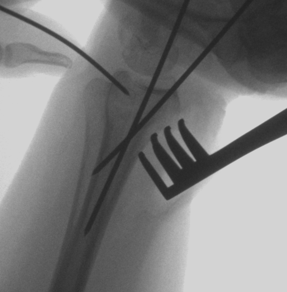 case image