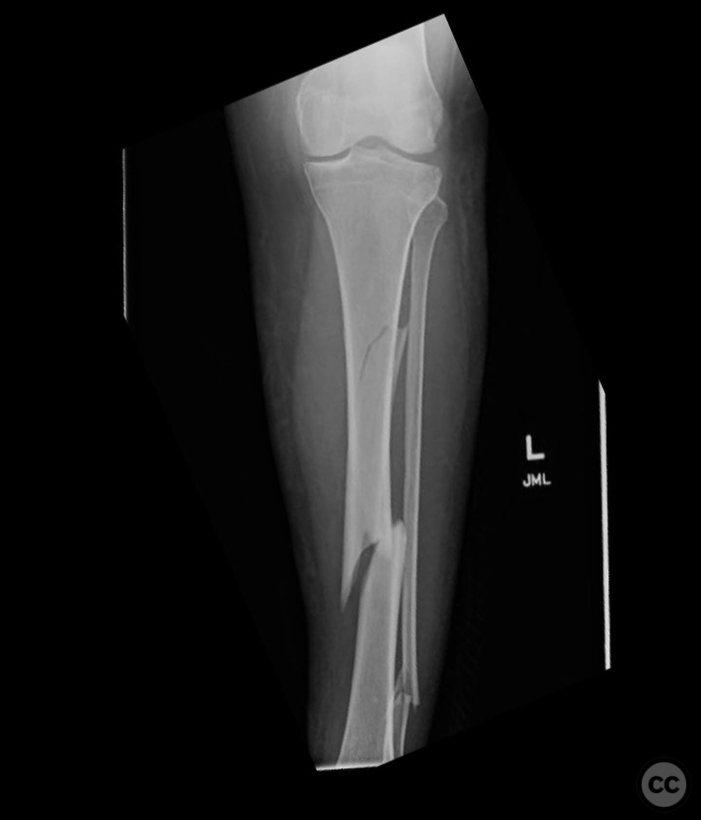 case image