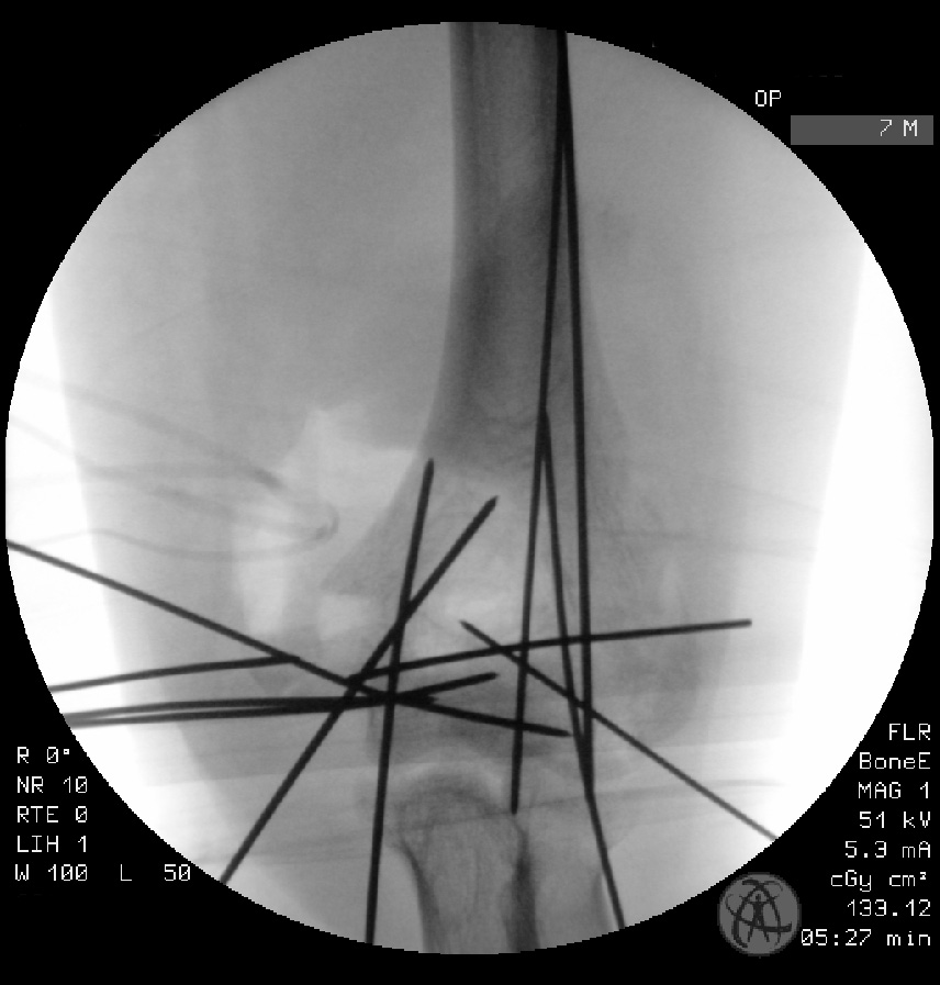 case image