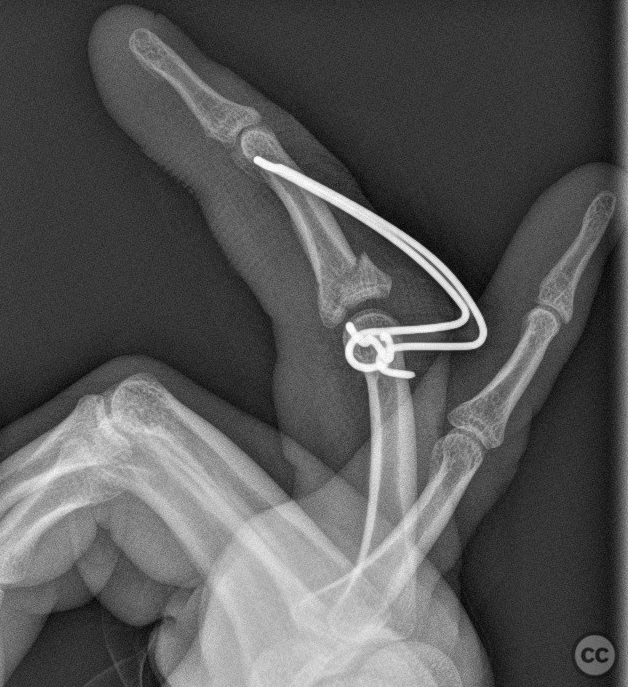 case image