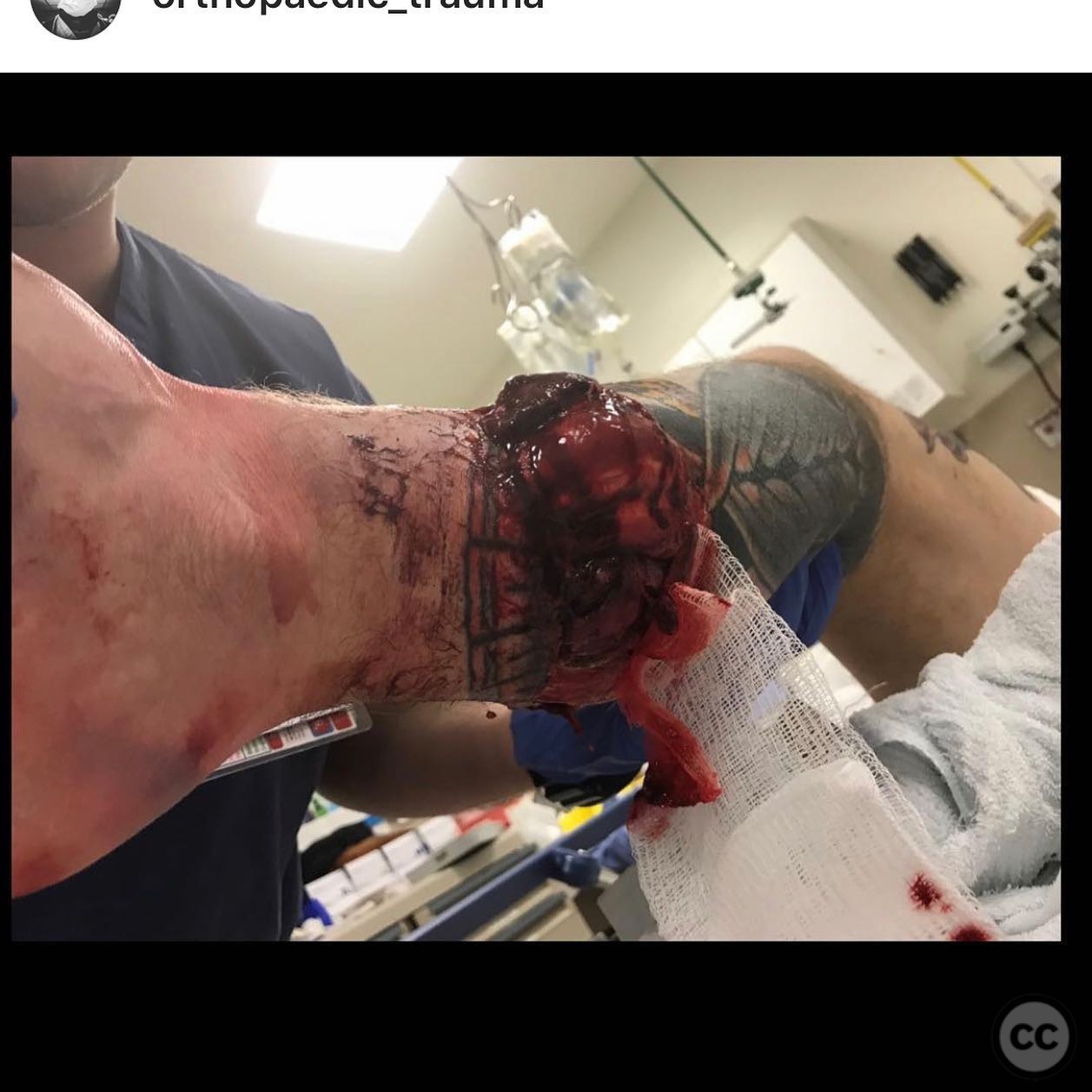 case image