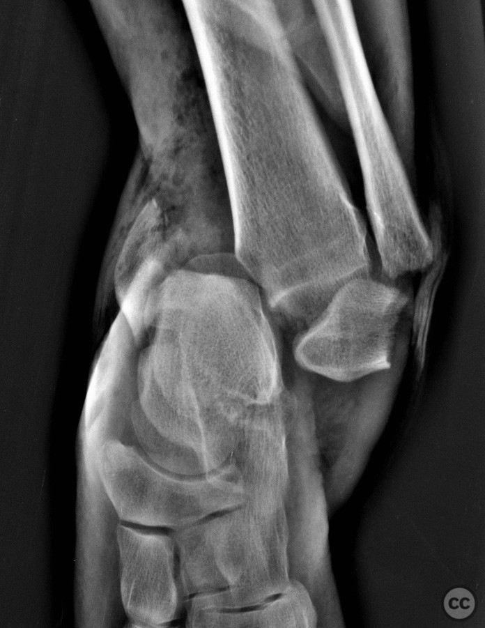 case image