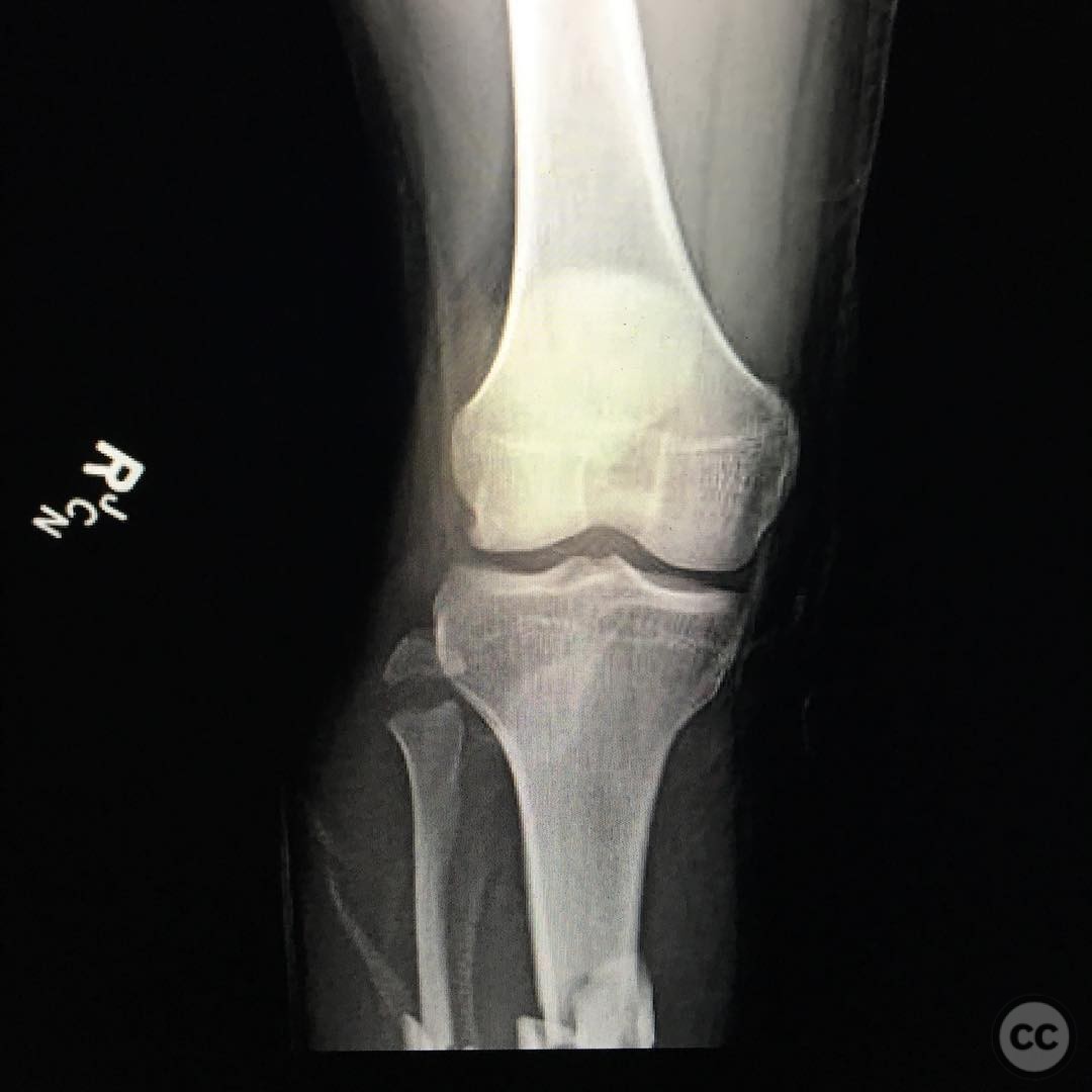 case image
