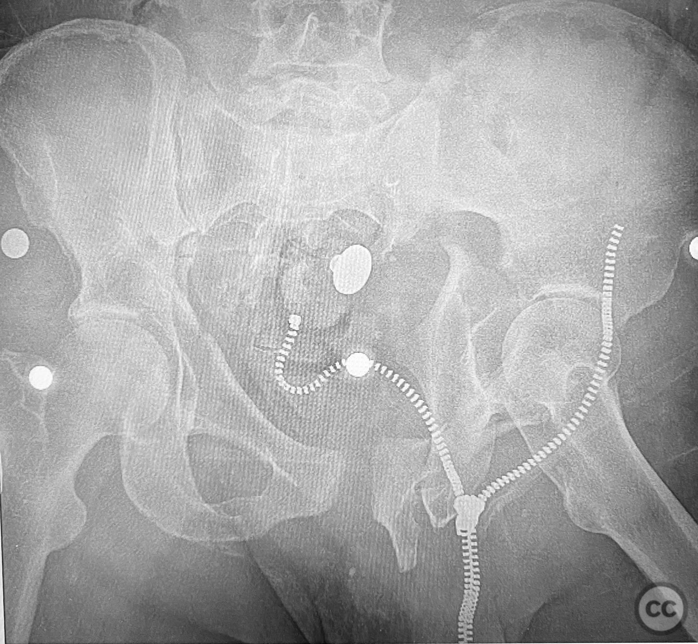 case image