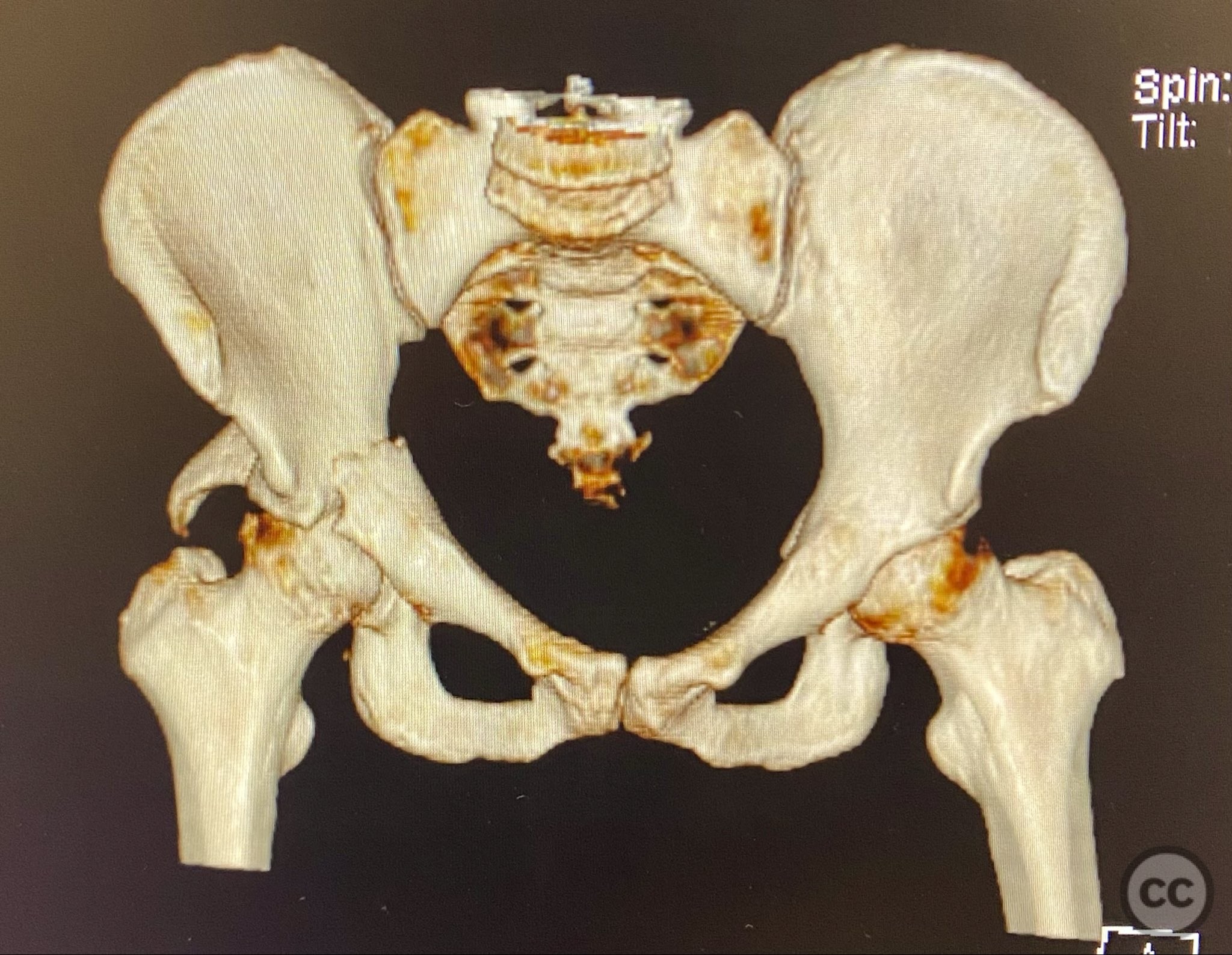 case image