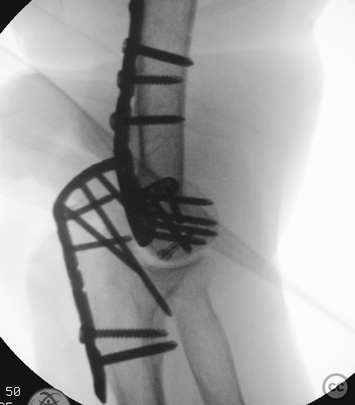 case image