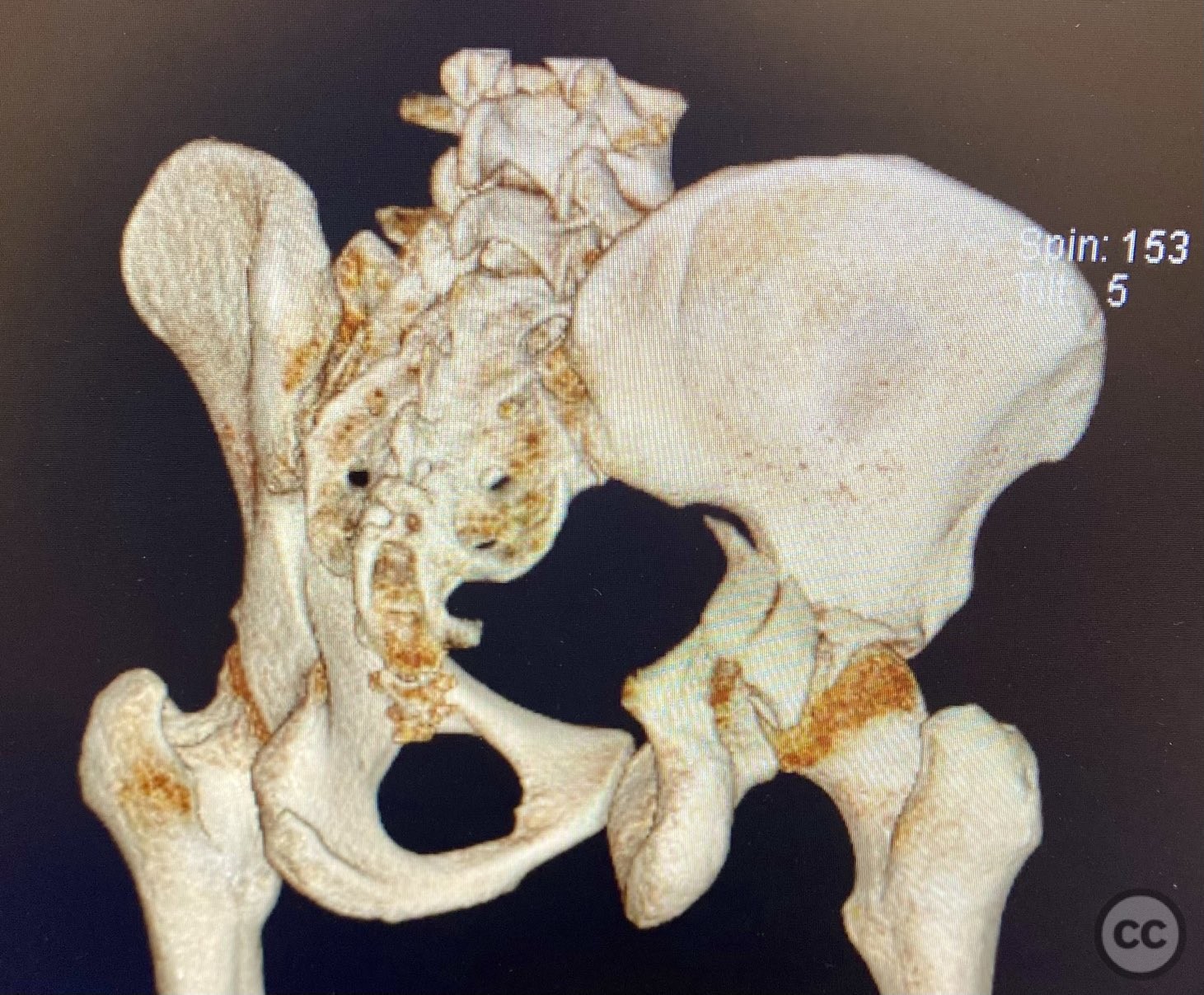 case image