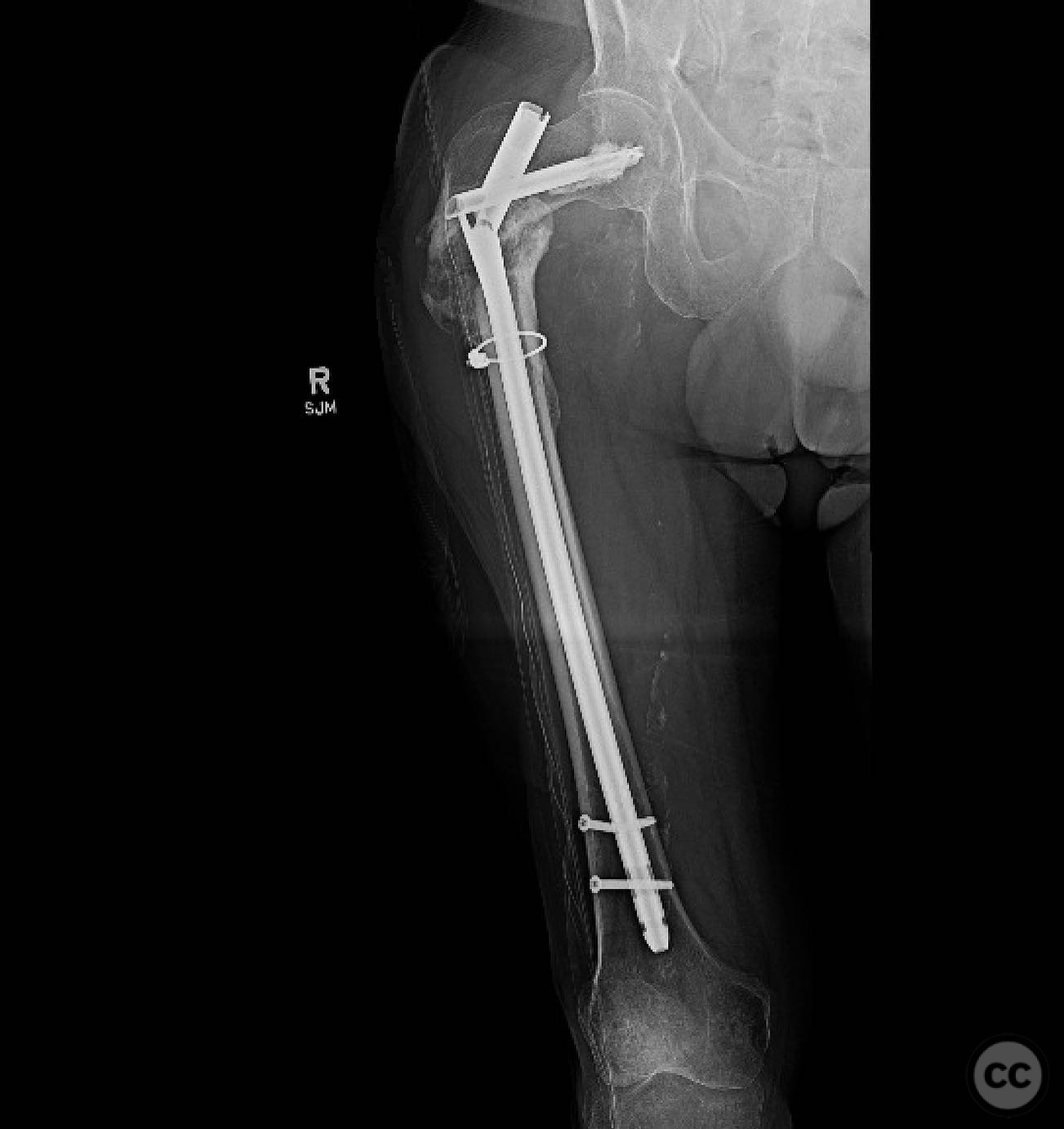 case image