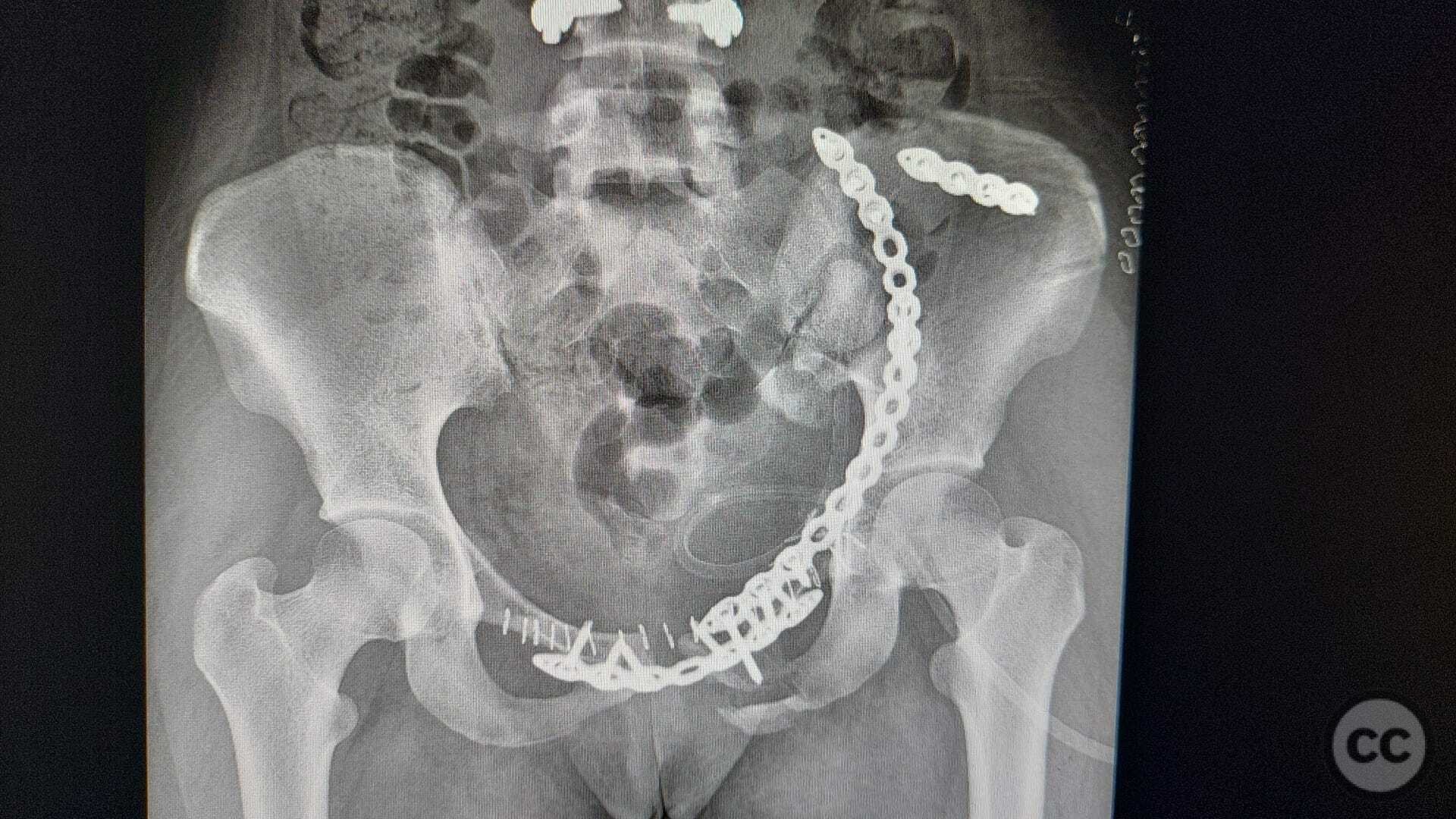 case image