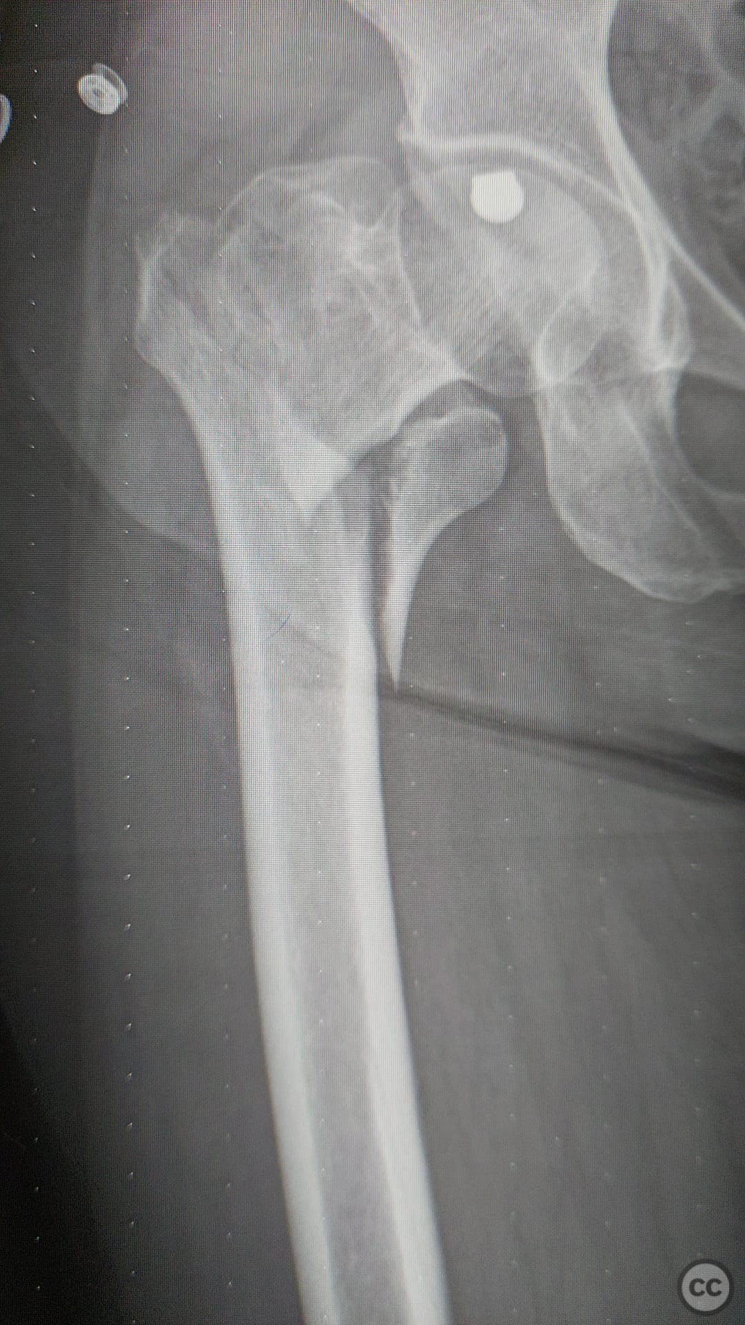 case image