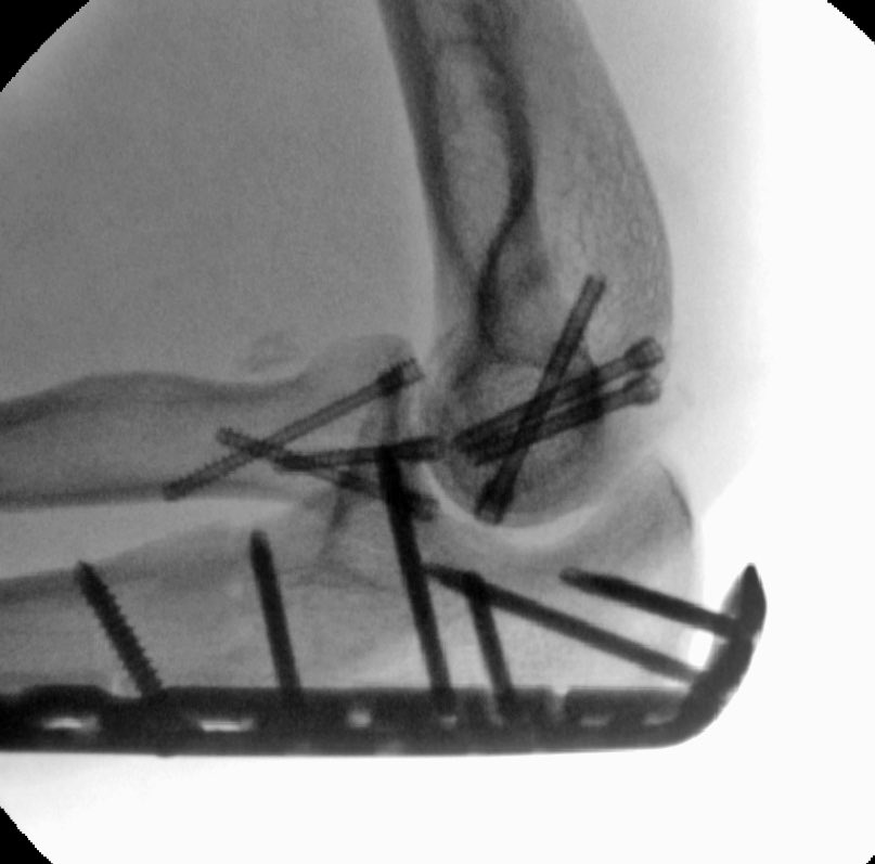 case image