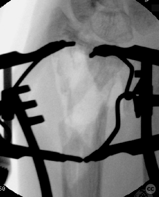case image