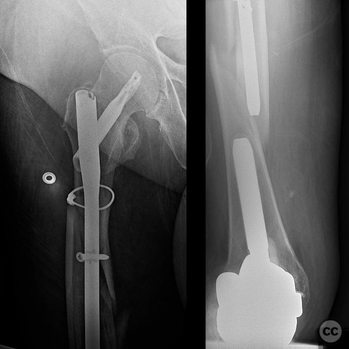 case image