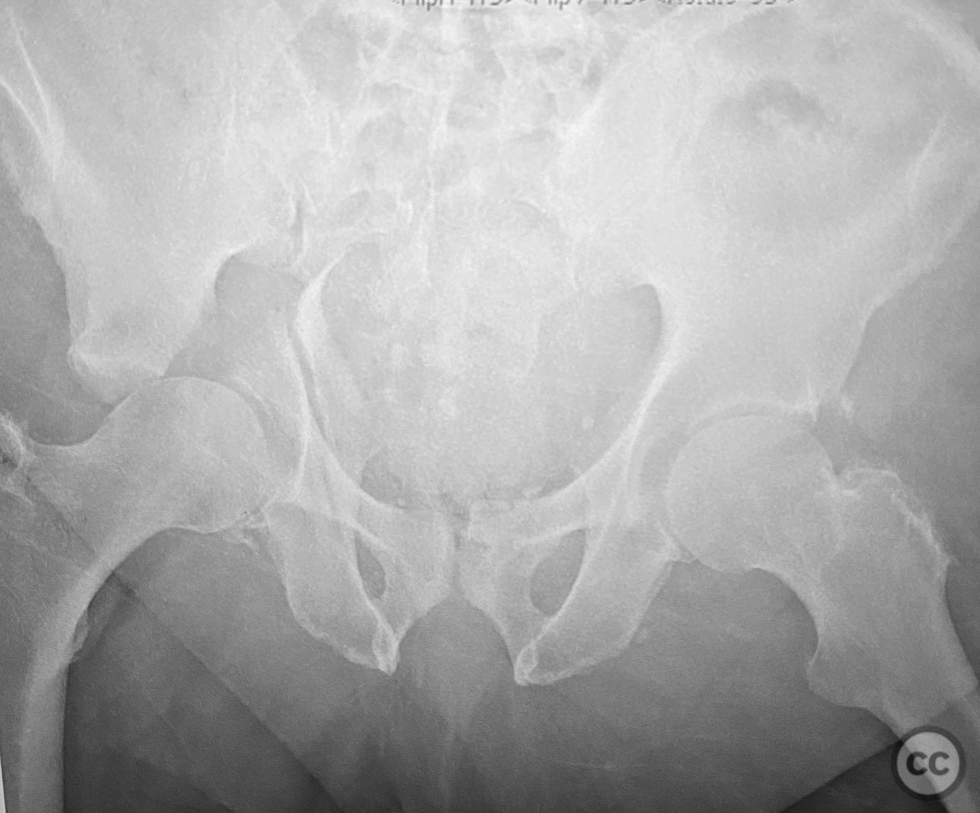 case image
