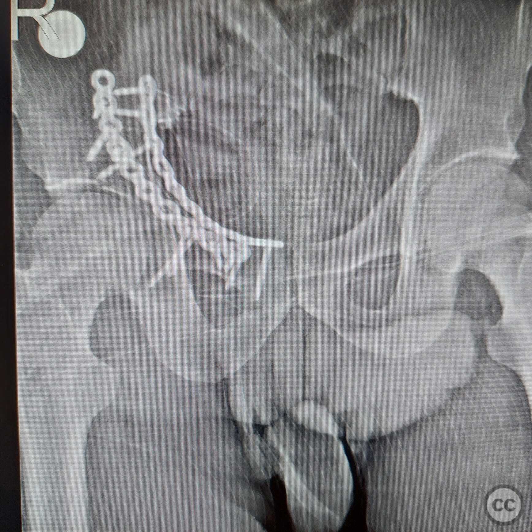 case image