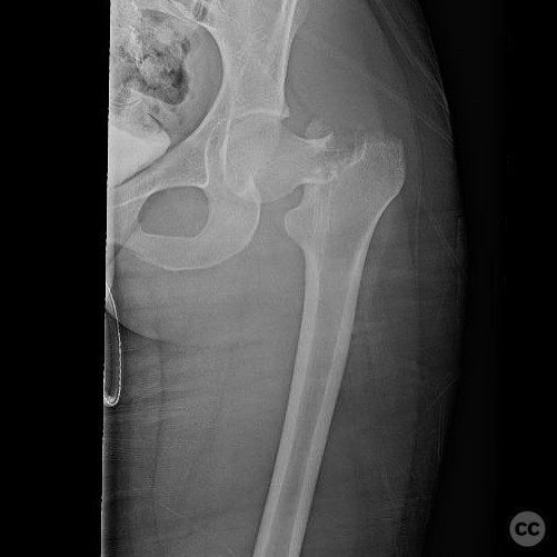 case image