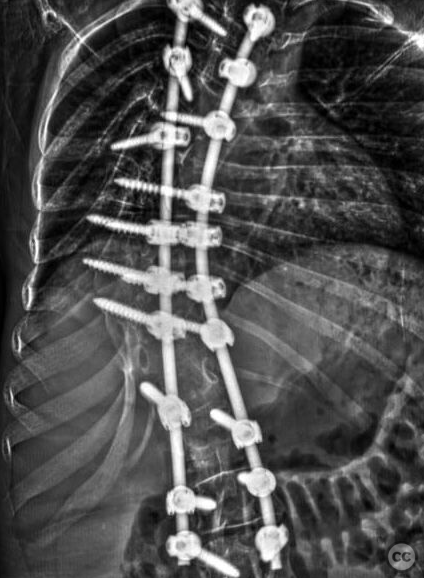 case image