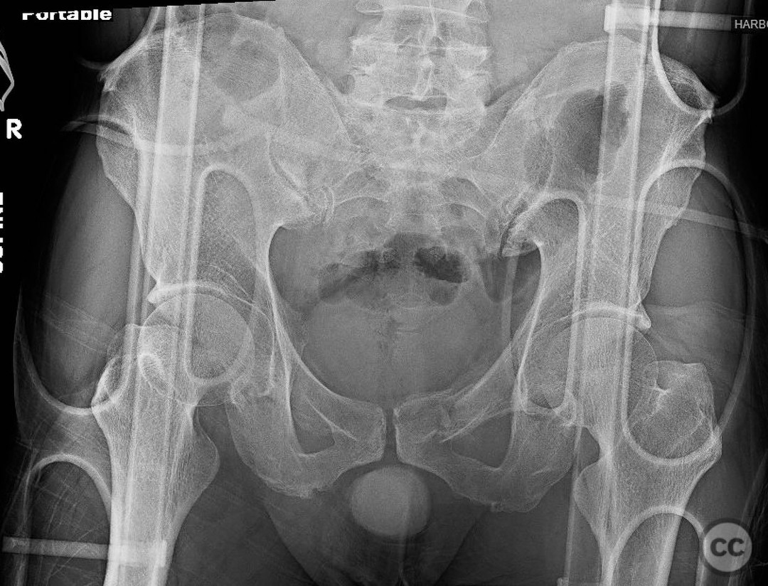 case image