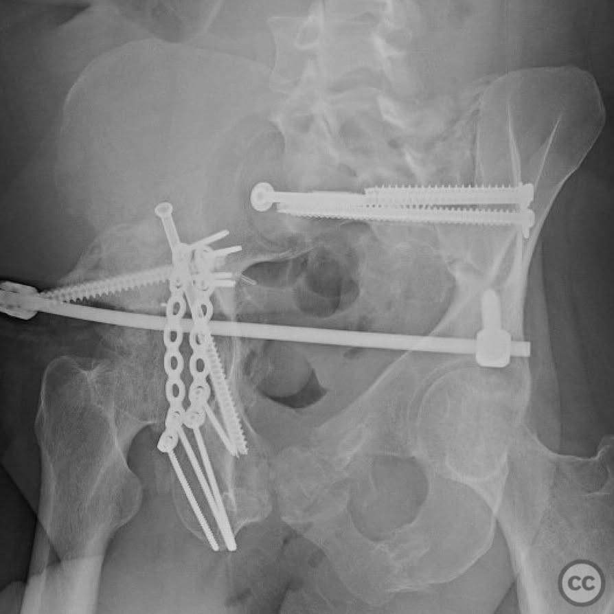 case image