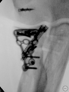 case image