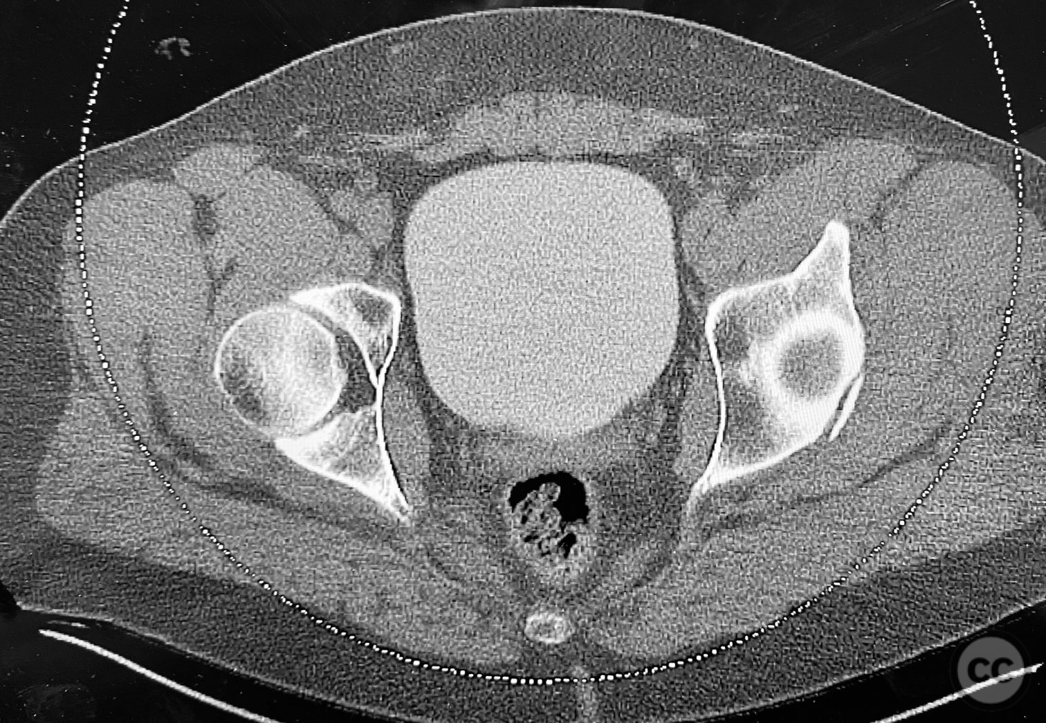 case image