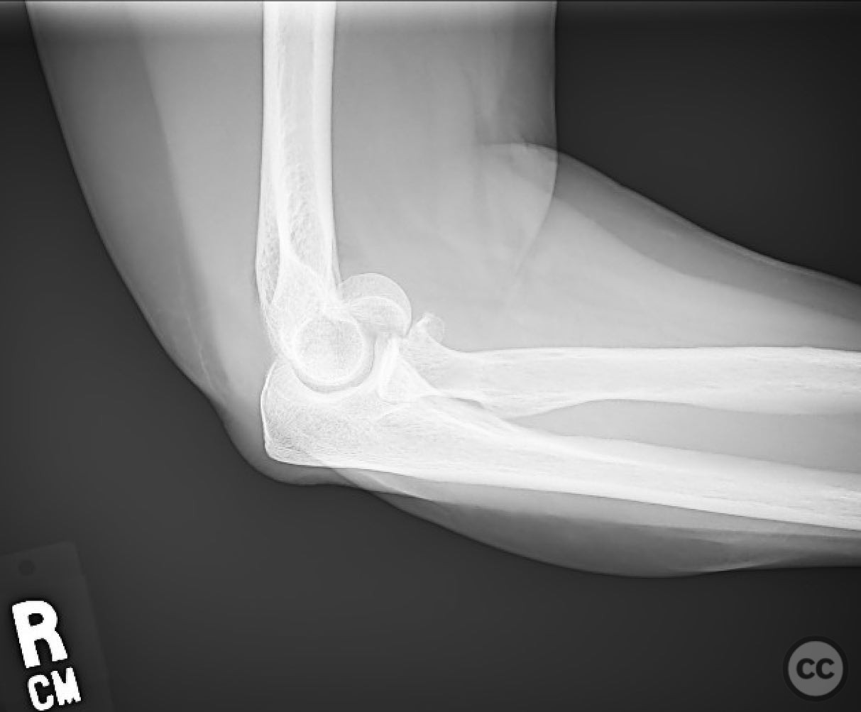 case image