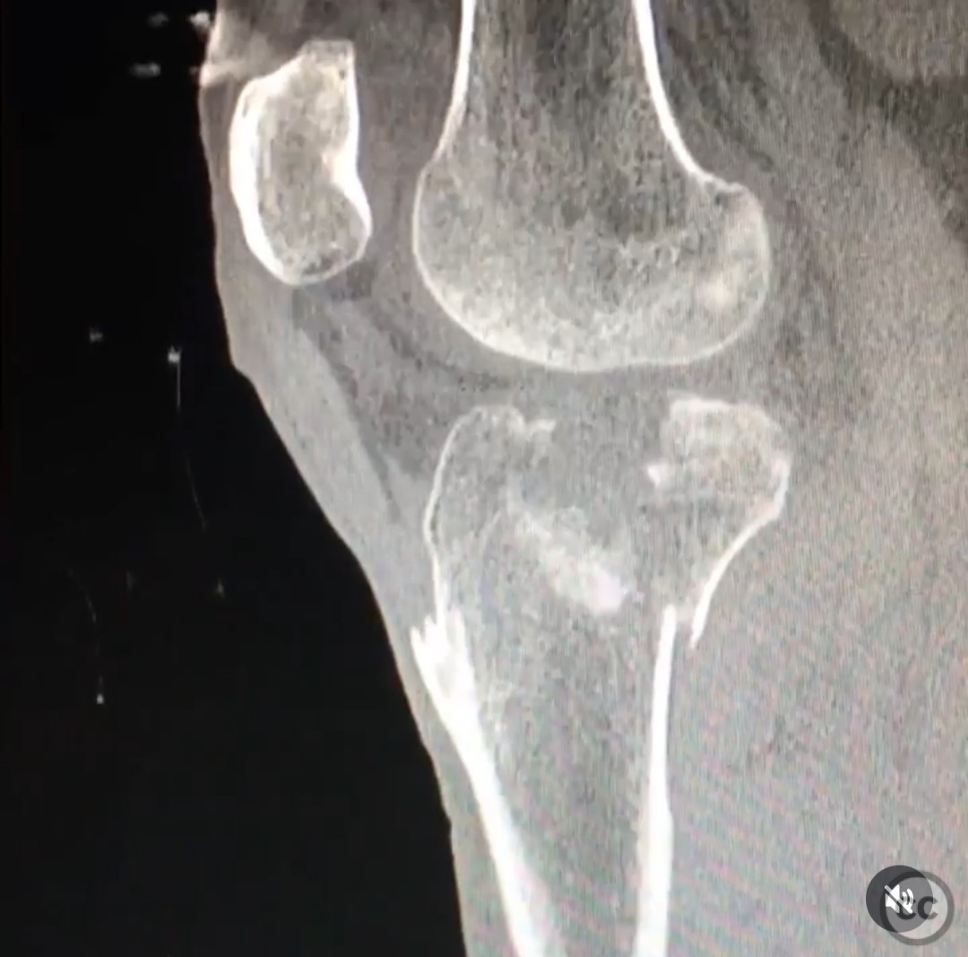 case image