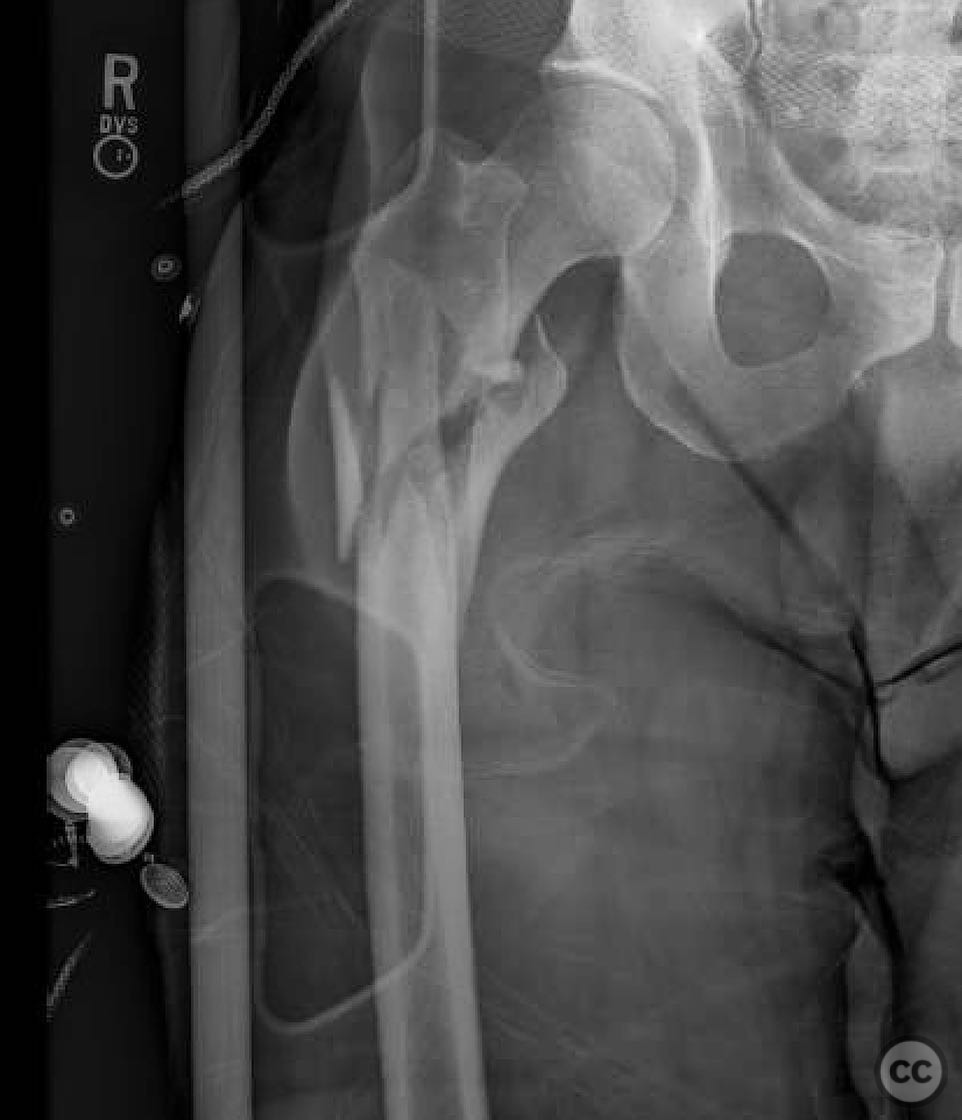 case image