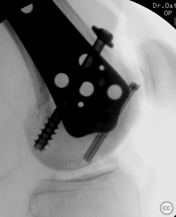 case image